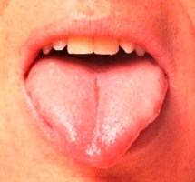 Болит кончик языка