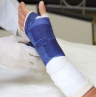 Как разработать руку после перелома?