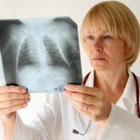 Опасен ли рентген при беременности?