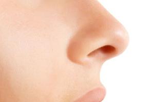 Полипы в носу: симптомы