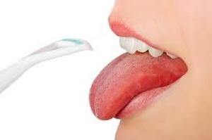 Белый налет на языке после антибиотиков