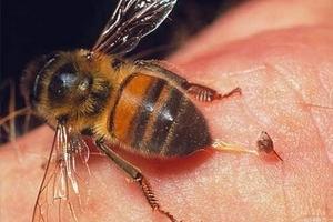Как снять отек после укуса пчелы?