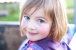 Красные белки глаз у ребенка: причины