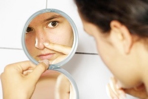 Как убрать белые жировики на лице?