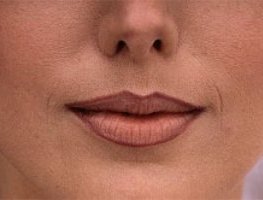 Как убрать морщины вокруг рта?