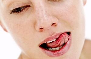 Что делать, если прикусил язык до крови?